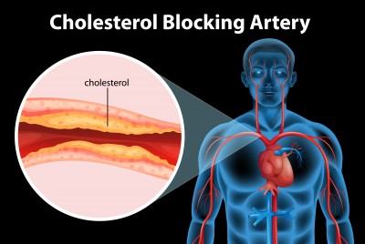 hgh deficiency cholesterol